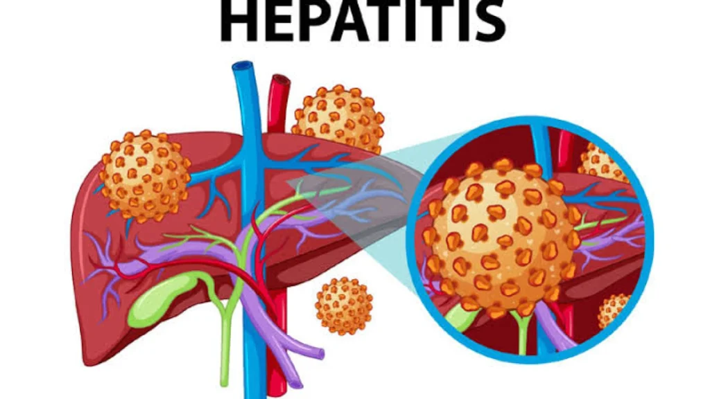 Menggugah Kesadaran: Hari Hepatitis Sedunia 2023